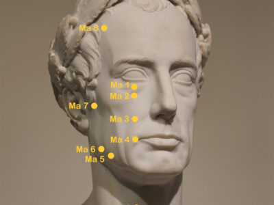 Magenmeridian am Kopf