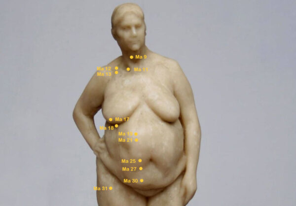 Magenpunkte am Oberkörper