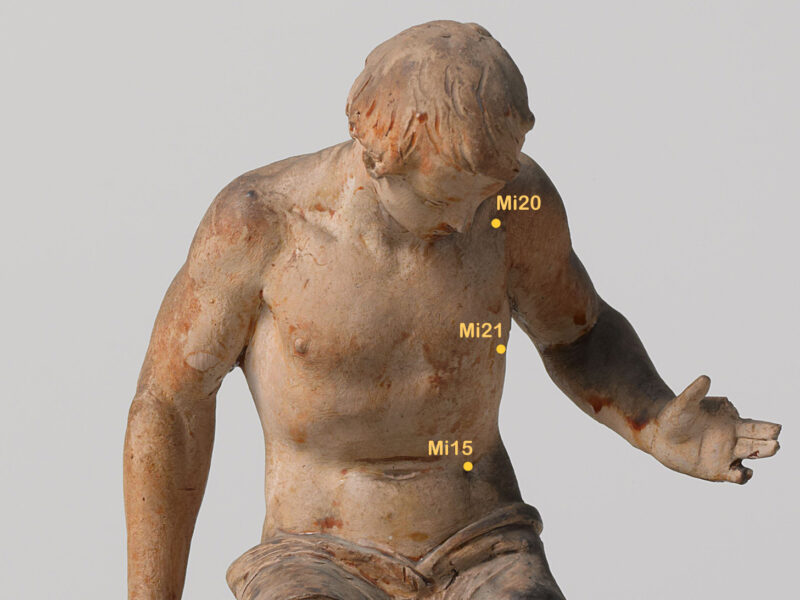 Milzpunkte Oberkörper