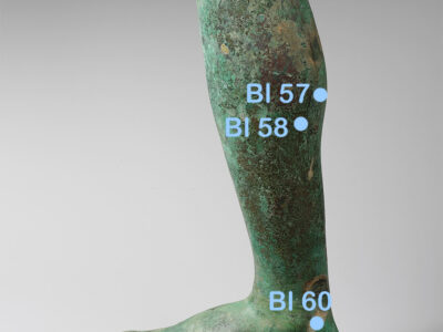 Blasenpunkte am Fuß