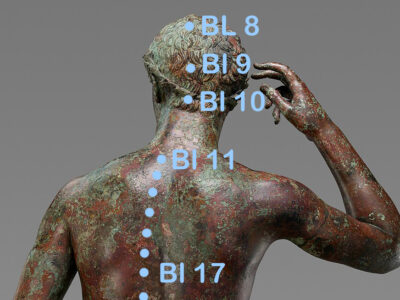 Blasenpunkte oberer Rücken