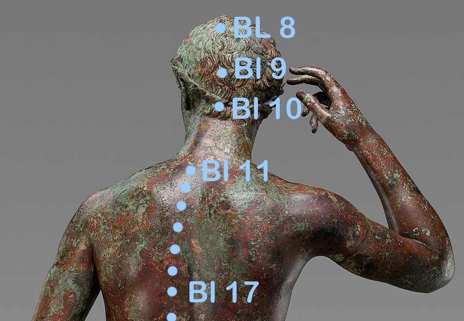 Blasenpunkte oberer Rücken