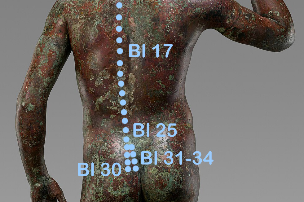 Blasenpunkte Rücken