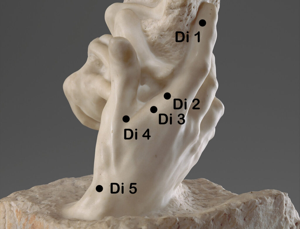 Dickdarm Punkte Hand