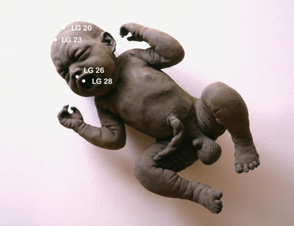 Lenkergefaess am Kopf