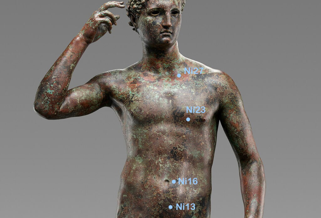 Nierenpunkte Brust und Bauch