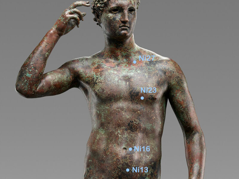 Nierenpunkte Brust und Bauch