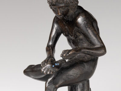 Nierenmeridian Fußunterseite