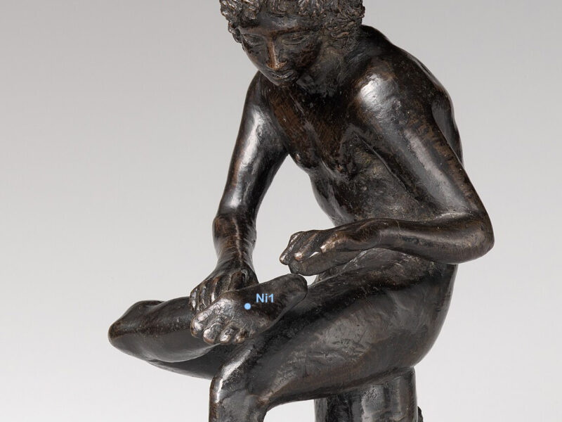 Nierenmeridian Fußunterseite