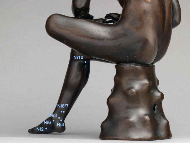 Nierenpunkte am Bein