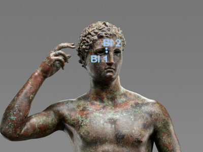 Blasenpunkte am Kopf