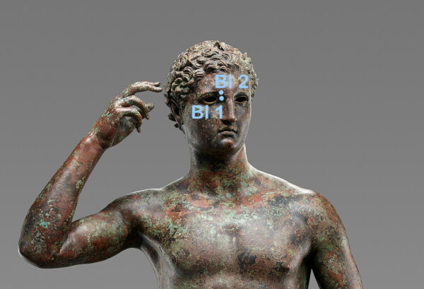 Blasenpunkte am Kopf