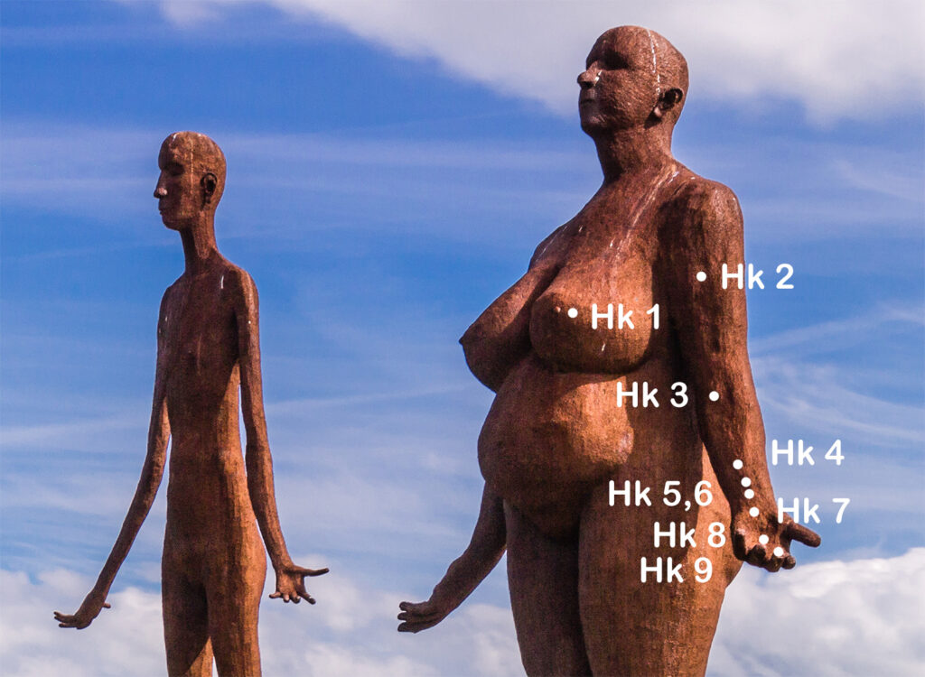 Herzkonstriktor am Arm