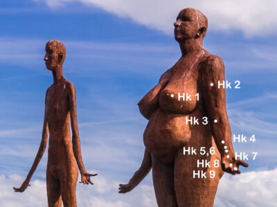 Herzkonstriktor am Arm